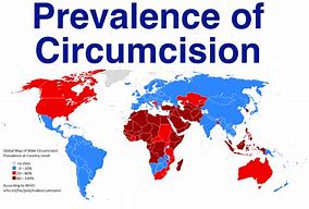 circumcise 的图像结果