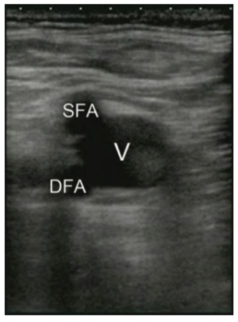 A Review of Human Circulatory System Simulation: Bridging the Gap ...