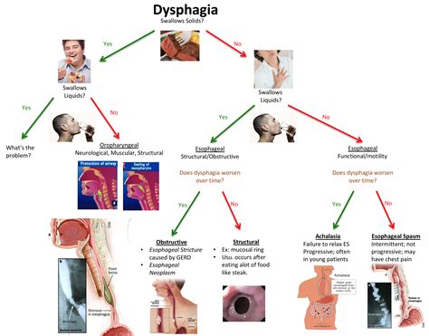 Solid Vs Liquid Dysphagia at James Aviles blog