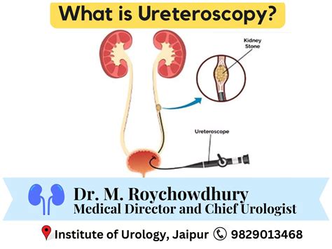 Anderson-Hynes Pyeloplasty Surgery for PUJ Obstruction