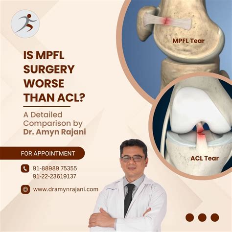 Is MPFL Surgery Worse Than ACL? - A Detailed Comparison by Dr. Amyn Rajani - Knee, Shoulder ...