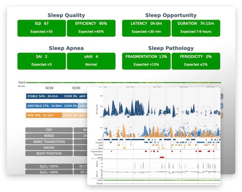 Sleep Connection Test 的图像结果