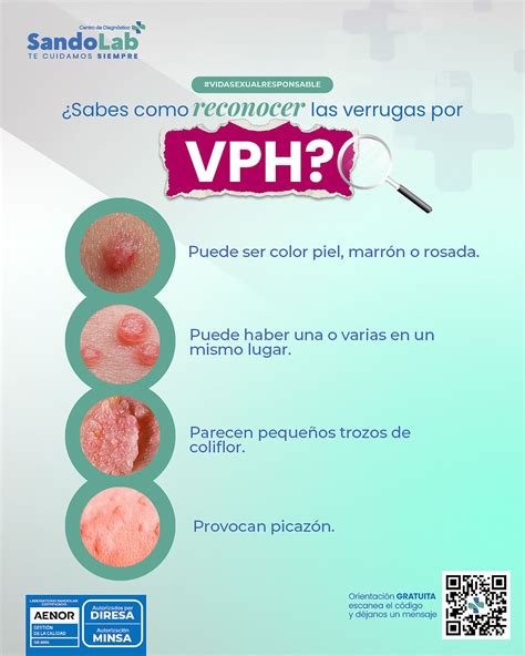 🔖Las verrugas genitales o condilomas son comunes y son causadas por ...