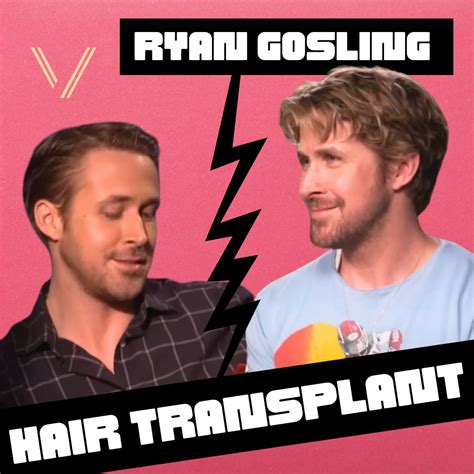 Ryan Gosling Hairline How Did Ryan Gosling Get These Waves? : R/Hair