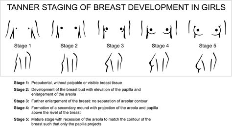 Breast Development Stages In Girls With Pictures
