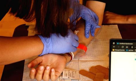 Los Angeles: U.S. confirms 16,926 monkeypox/orthopoxvirus cases