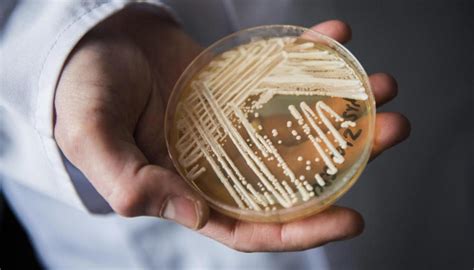 致死率达60%！中国已确诊有感染"超级真菌"病例！但别慌……浙江专家回应来了！_患者