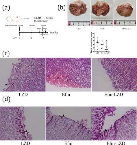 Image result for Enterococcus Faecalis Colon Cancer