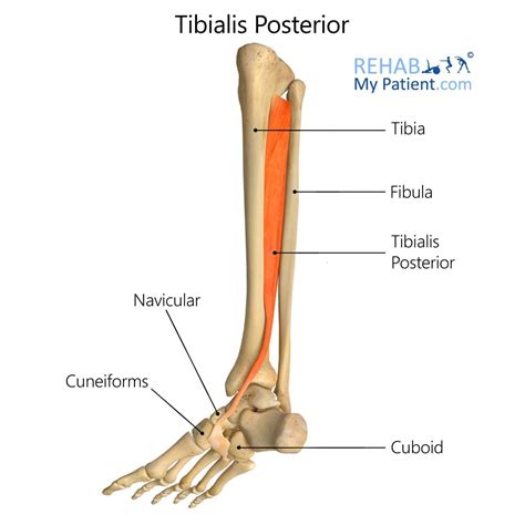 Posterior Tibial Tendon Dysfunction | Manor View Practice