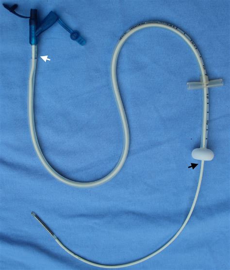 [PDF] JEJUNOSTOMY TUBES: THROUGH GASTROSTOMY OR NASAL | Semantic Scholar