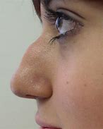 Image result for Bunny Nose Pattern