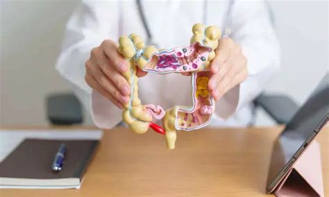 No evidence that medications trigger microscopic colitis in older ...