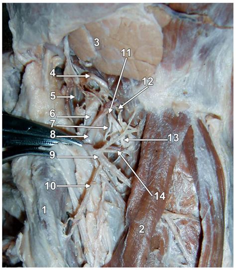 The Sensory Gatekeeper of the Larynx: Anatomy and Clinical Importance ...