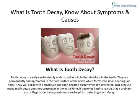 PPT - What Is Tooth Decay, Know About Symptoms & Causes PowerPoint Presentation - ID:9006948
