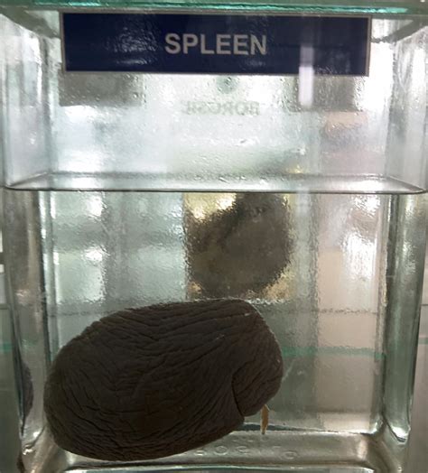 3.SPLEEN | NAMO Medical Education & Research Institute