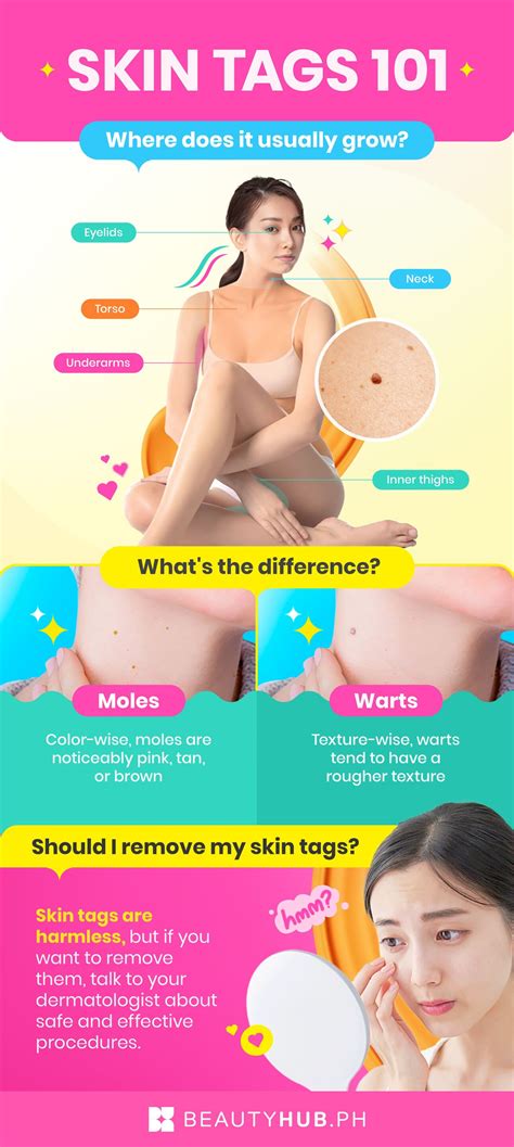 Skin Tag vs. Wart: How to Tell Them Apart | AllThingsBeauty