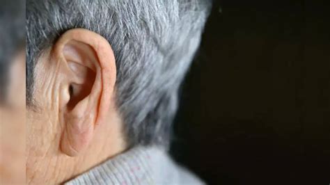 Can You Predict Heart Attack With An Ear Lobe Crease? Experts Don't ...