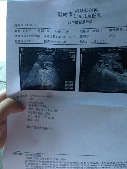 怀孕19周，胎儿大畸形筛查检查出胎儿室间隔上段双向穿隔血流，该怎么办？ - 知乎
