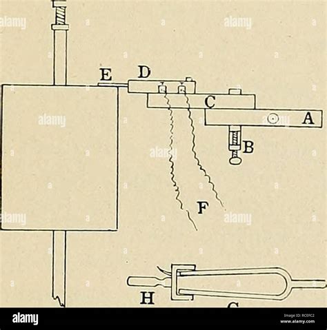 Image result for Myogram