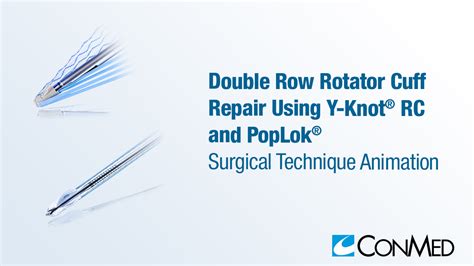 Image result for Single Row Rotator Cuff Repair