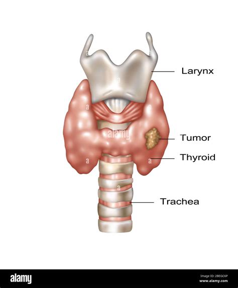 Thymus Gland Vs Thyroid at Darcy Housley blog