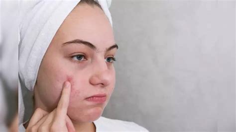 Five Weird Signs That Tell You Are Vitamin Deficient; Ways To Fix It ...
