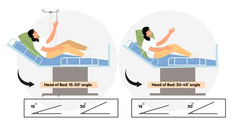 Patient Positioning Insights