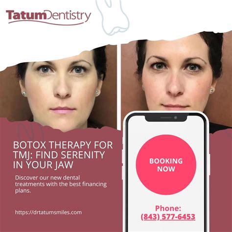 Botox for TMJ: A Revolutionary Treatment for Jaw Pain at Tatum Dentistry