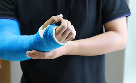 Hand Surgery | Methodist McKinney Hospital