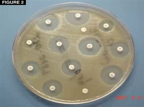 Microbiological culture sensitivity test | PPTX