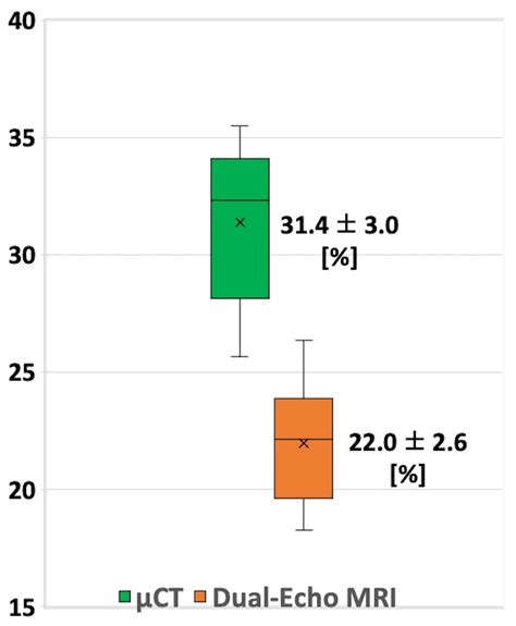 Estimation of Trabecular Bone Volume with Dual-Echo Ultrashort Echo ...