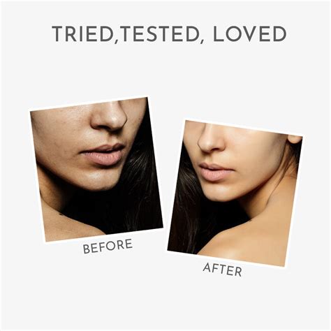 Best Vitamin C Serum for All Skin Types by Himaira