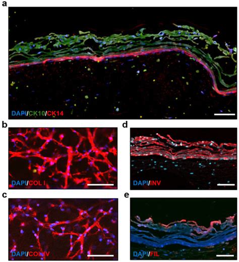 Full-Thickness Perfused Skin-on-a-Chip with In Vivo-Like Drug Response ...