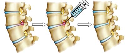 Cell Injection 的图像结果