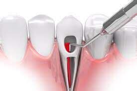 No difference in pain perception found between single- and multiple ...
