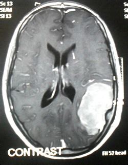 Dr. Partha Pratim Bishnu - India / Kolkata, Total Microsurgical ...