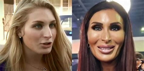 Laura Loomer Before and After plastic surgery Memes - Imgflip
