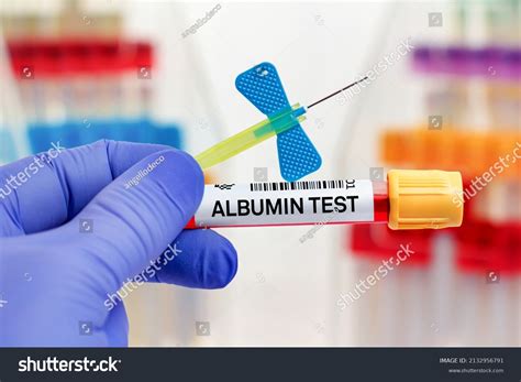 Lab Test For Albumin