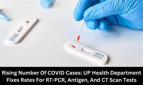 UP Health Department fixes rates of COVID tests at private pathology ...