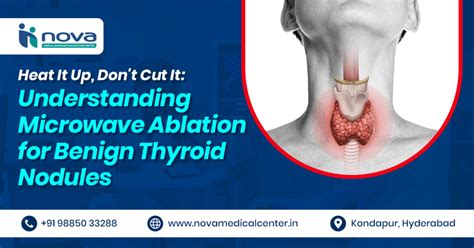 Understanding Microwave Ablation for Thyroid Health: A Non-Surgical ...