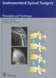 Instrumented Spinal Surgery: Principles and Technique : Amazon.in: Books