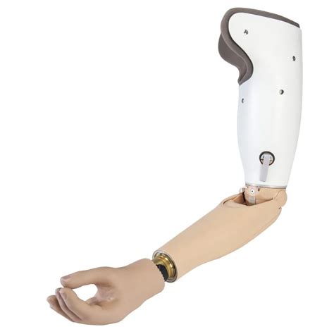 Prosthetic Partial Hand & Fingers in Las Cruces & Albuquerque ...