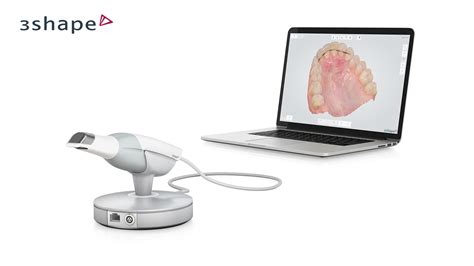 The 3Shape TRIOS® Intraoral Scanner