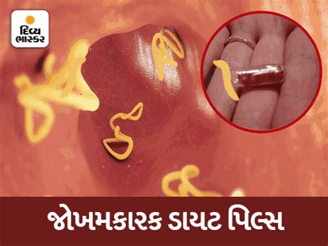 One pill of tapeworm diet costs 1.25 lakhs but dangerous for liver and ...