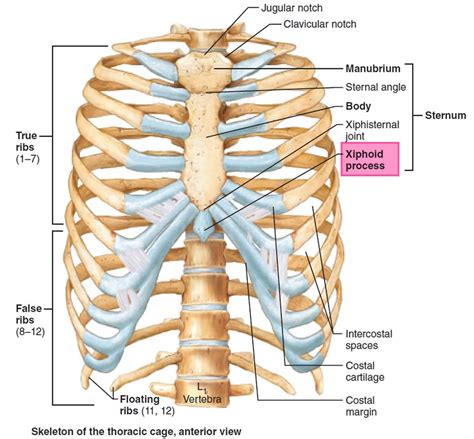 Xiphoid Process Problems 的图像结果