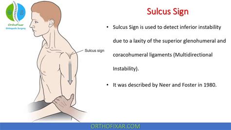 Sulcus Sign Explained 的图像结果
