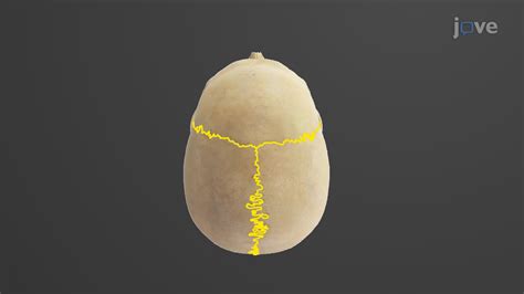 Video: Sutures of the Skull