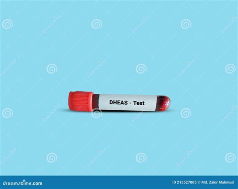 Test Tube with Blood Sample for DHEAS Test. Stock Image - Image of blood, health: 215527005