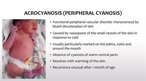 Common skin conditions in neonates | PPTX