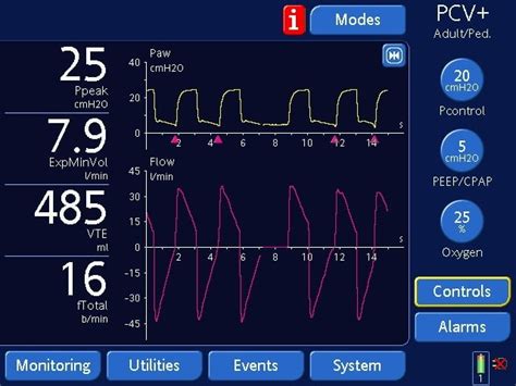 Image result for Normal Pressure Control Settings